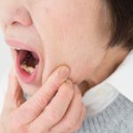 口・歯の後遺症の慰謝料