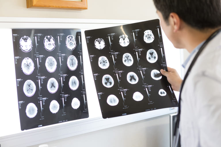 後遺障害診断書を整骨院に通院していた場合に入手するポイント